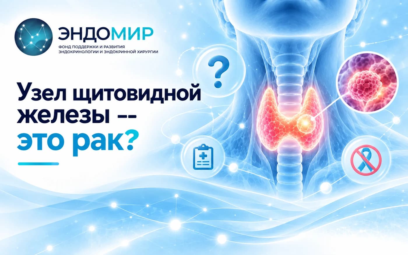 Узел щитовидной железы — это рак?